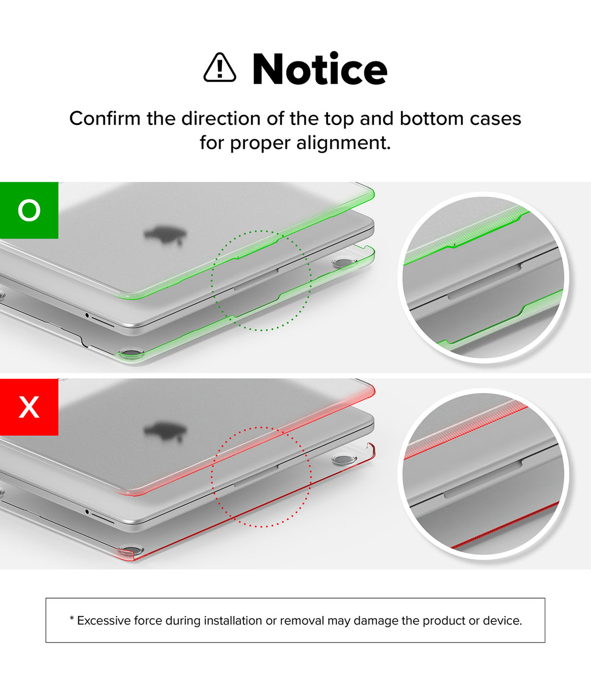 MacBook Neo | Slim - Instruction graphic showing how to install or remove clear protective cases on a silver tablet, with a notice section, directional arrows, and circular close-up insets indicating correct green alignment versus incorrect red alignment.